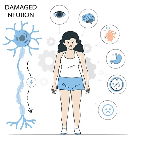 علائم ام اس